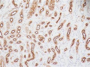 3285A | Control Slides:Immunopathology; Epithelial Membrane Antigen (EMA)